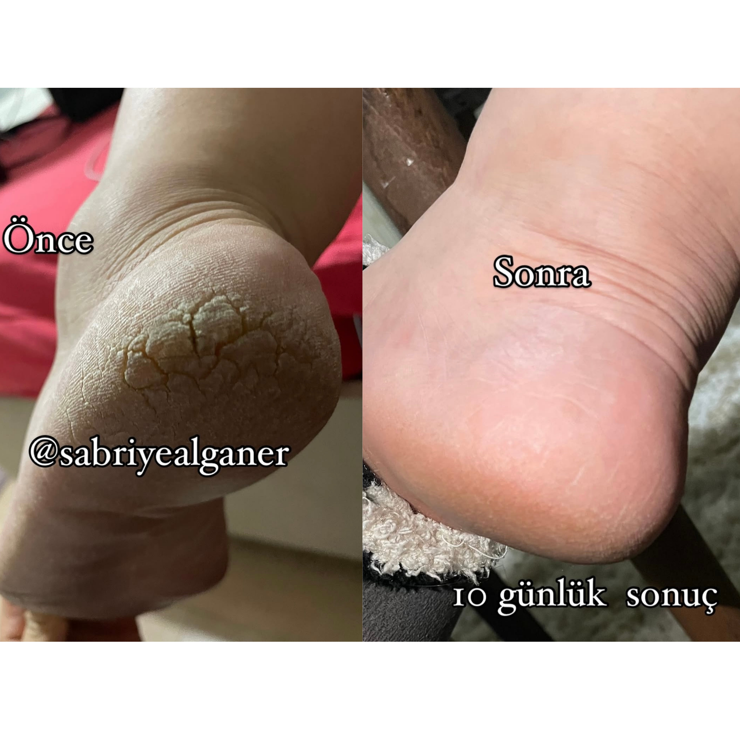 Sabral Topuk Onarıcı Bakım Yağı  (Topuk • El • Ayak • Dirsek Bakımı ) 50 ml